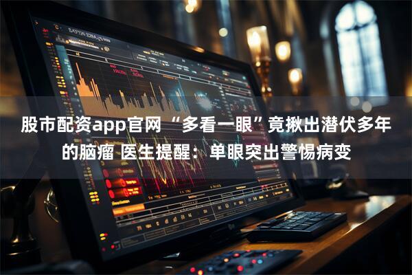 股市配资app官网 “多看一眼”竟揪出潜伏多年的脑瘤 医生提醒：单眼突出警惕病变